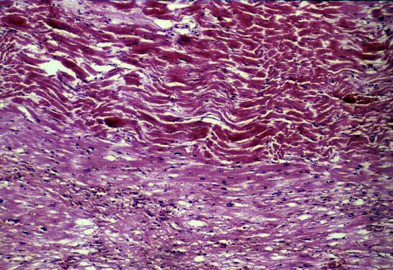 Systemic_Cardiovascular System