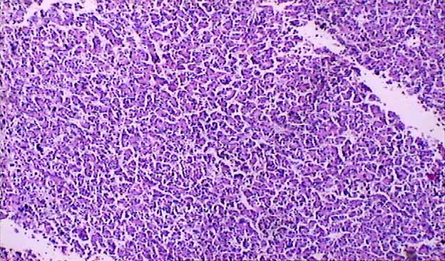 Systemic - Liver