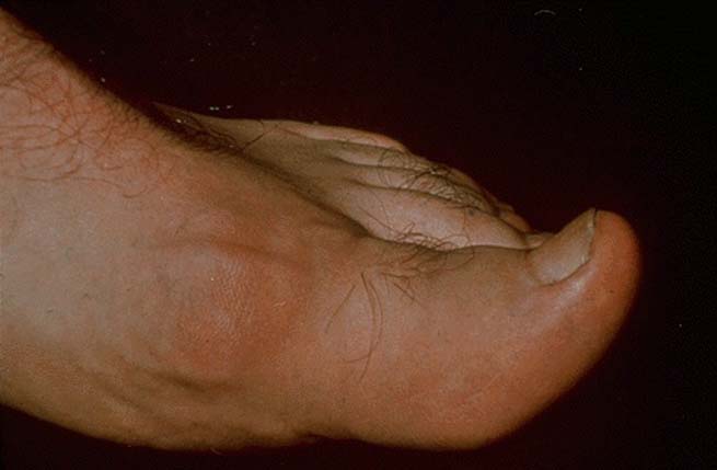 gout03.jpg 25.0K
