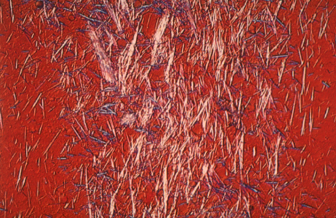 gout06.jpg 244.5K