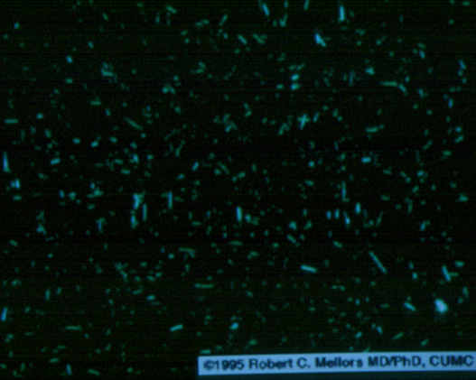 gout07.jpg 85.1K