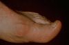 gout13.jpg 1.6K