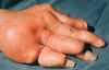 gout14.jpg 2.3K