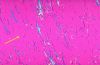 gout15.jpg 2.0K