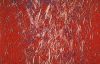 gout16.jpg 2.6K