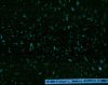 gout17.jpg 2.2K