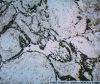 gout17lysosome1.jpg 4.1K