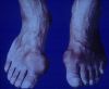 gout20tophiTOE1.jpg 2.3K