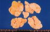 gout24tophiGROSS1.jpg 2.7K