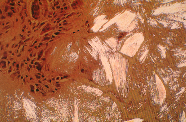 gout26tophipolarized.jpg 198.2K