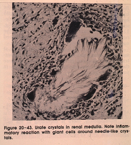 gout30.jpg 133.4K