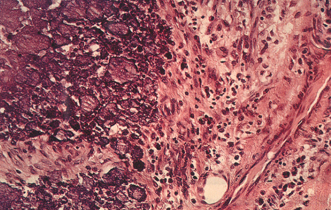 gout40pseudogout06.jpg 312.8K
