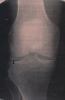 gout40pseudogout08.jpg 1.5K