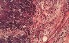gout40pseudogout12.jpg 3.4K