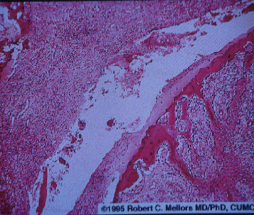 infectiveAR03.jpg 152.6K