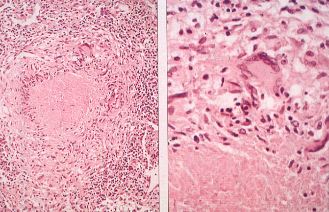 infectiveAR12.jpg 215.9K