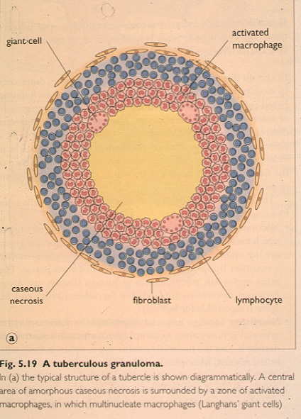 infectiveAR13.jpg 124.6K