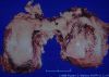 infectiveAR16.jpg 2.5K