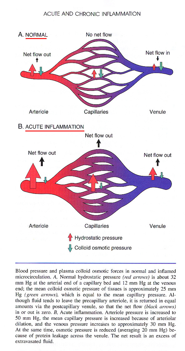 Inflammation_pic02.jpg 569.2K