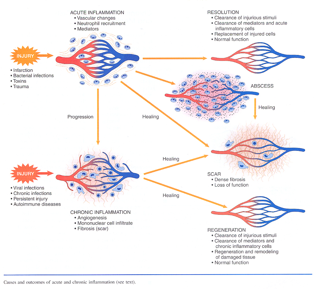 Inflammation_pic20.jpg 804.7K