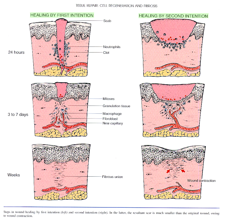 Inflammation_pic33.jpg 771.1K