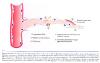 Inflammation_pic65.jpg 1.8K