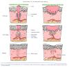 Inflammation_pic67.jpg 3.0K