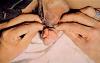 07condylomapenis1.jpg 2.3K