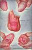 09drawingneoplasmpenis2.jpg 2.5K