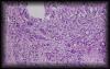 11caprostate3.jpg 2.4K