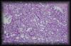 12caprostate4.jpg 2.5K