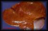 11cystofepididymis1.jpg 1.9K