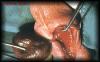 161torsiontestis1.jpg 2.4K