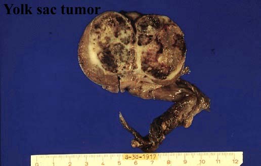 26gttylk01.jpg 26.0K