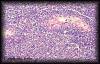 37lymphomatestis2.jpg 3.0K