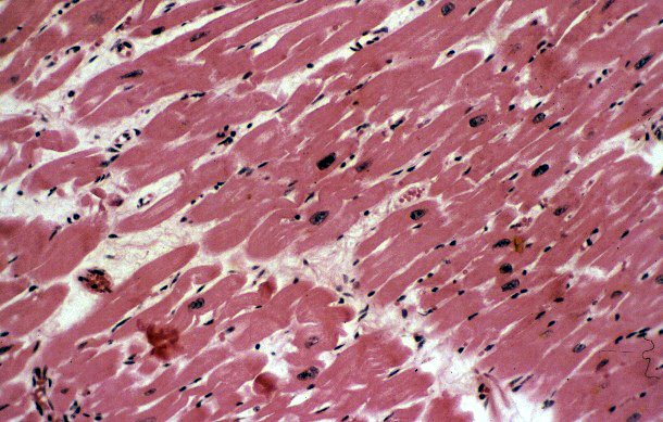Systemic_Cardiovascular System