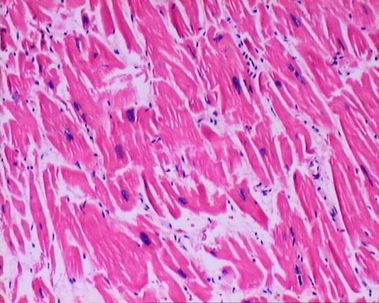 Systemic_Cardiovascular System