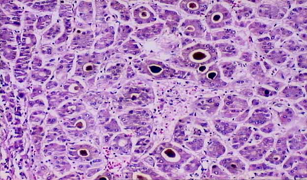 Systemic - Liver