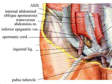 hernia2a.JPG (113988 bytes)