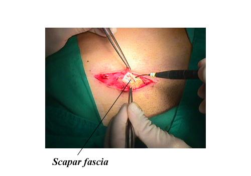 herniar03.jpg (85631 bytes)