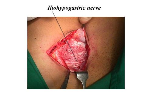 herniar09.jpg (94189 bytes)