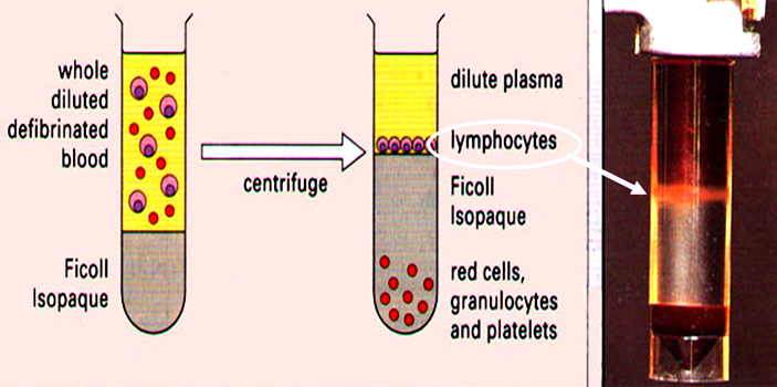 Density-gradient separation of lymphocytes on Ficoll Isopaque