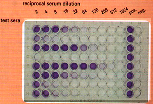 ELISA plates