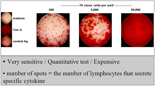 IFN-gamma ELISPOT RESULT