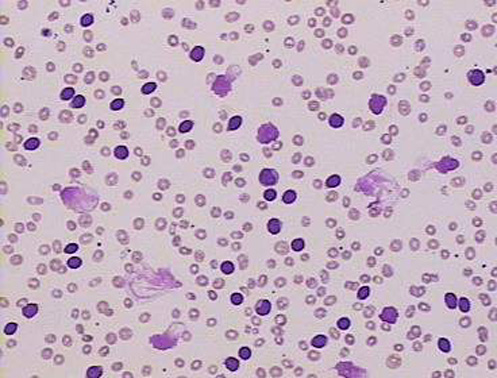 cll